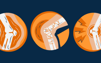 Comment gérer les blessures du LCA sans compromettre les rêves de tes athlètes